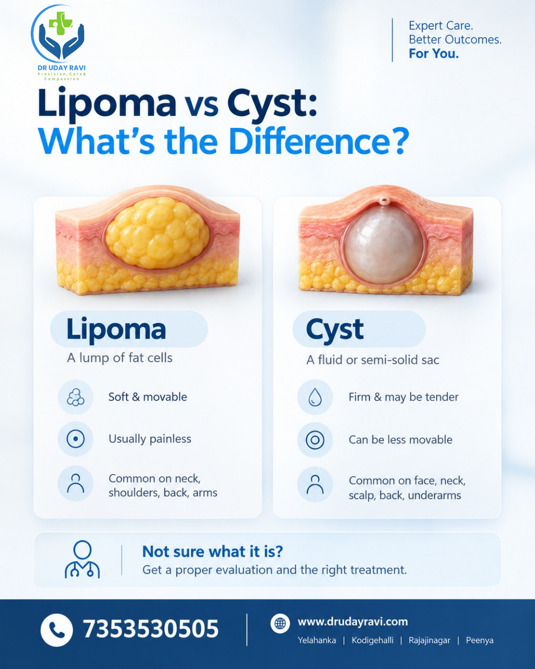 Lipoma vs Cyst: Why Correct Diagnosis Matters
